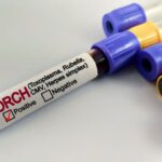 Bloedmonster positief voor rubella